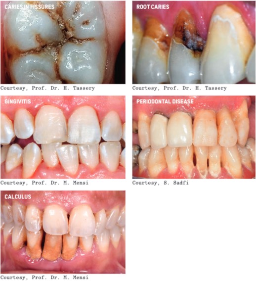 Diseases